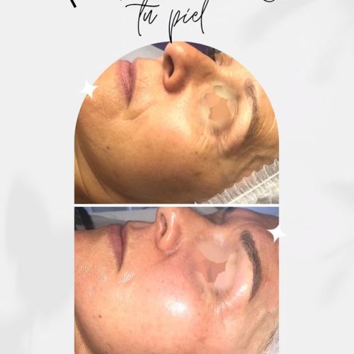 305507874_117316050971782_1493148522756102301_n